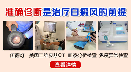 颈部白癜风为什么出现扩散